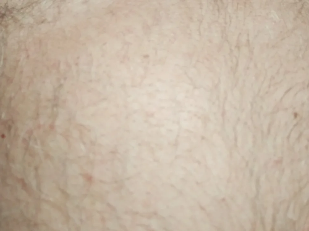 Ficose