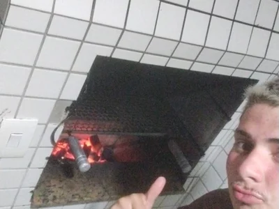 AnteriorPseudo profile