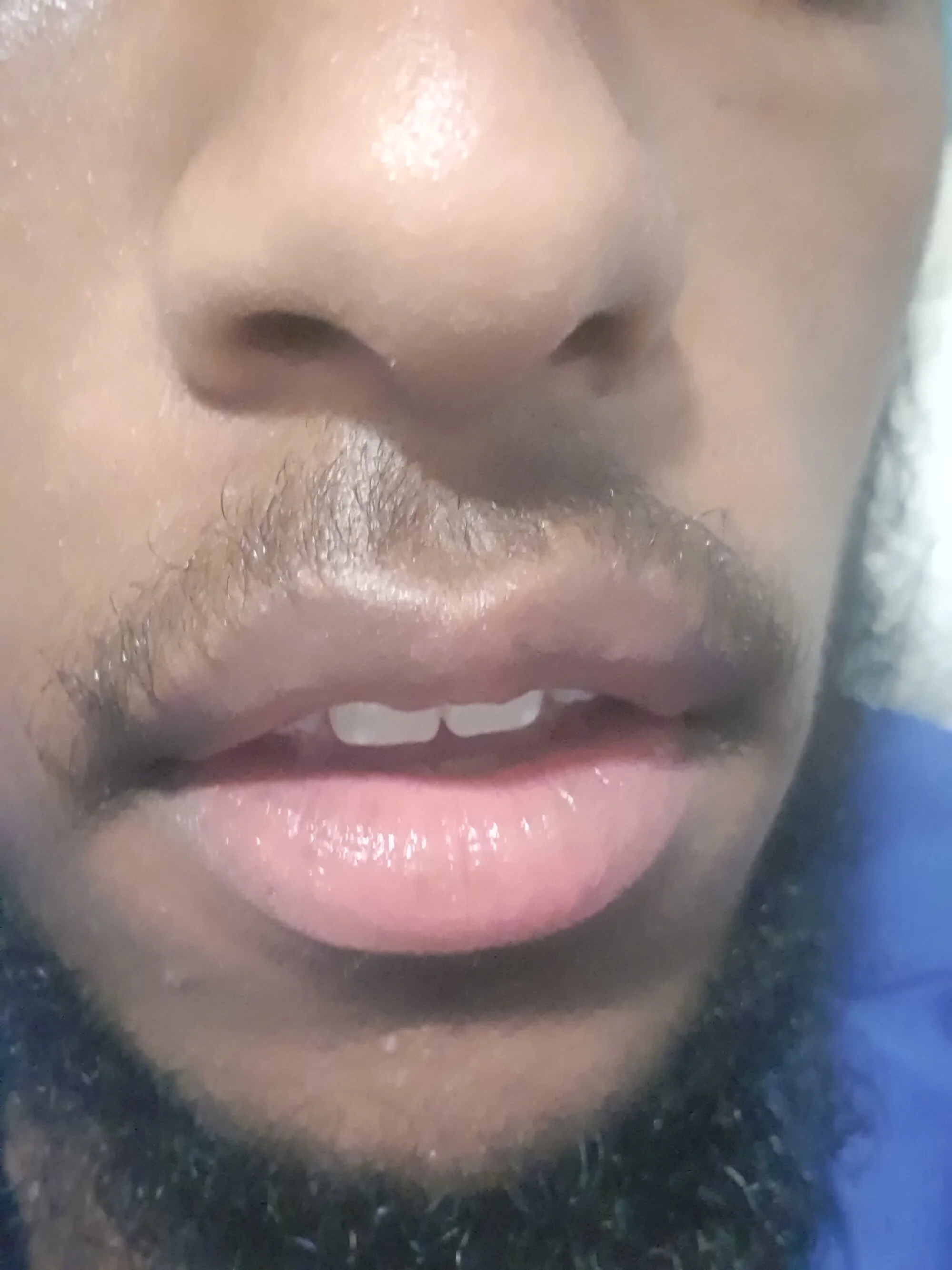 yourebonyboy