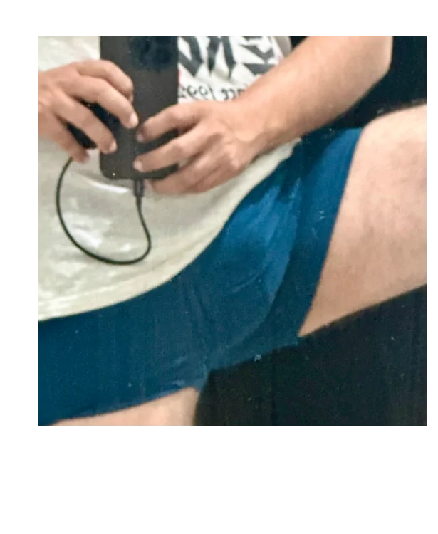 POXmx