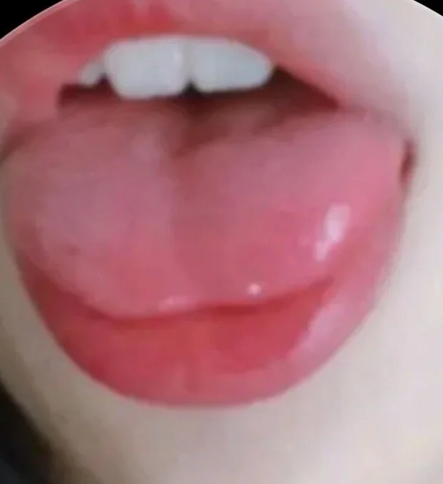 Nana_se