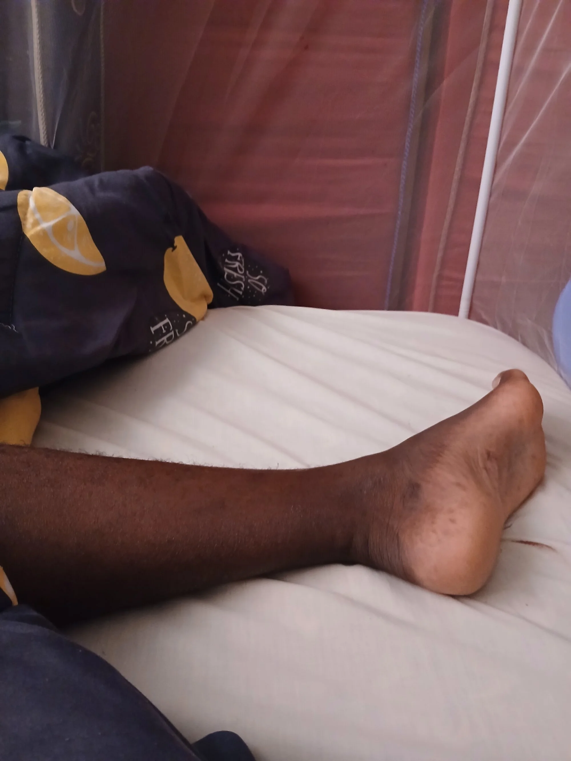 Uni-type live webcam