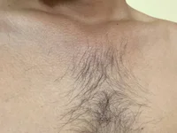 HairyR