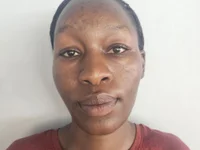 Dimple_gal