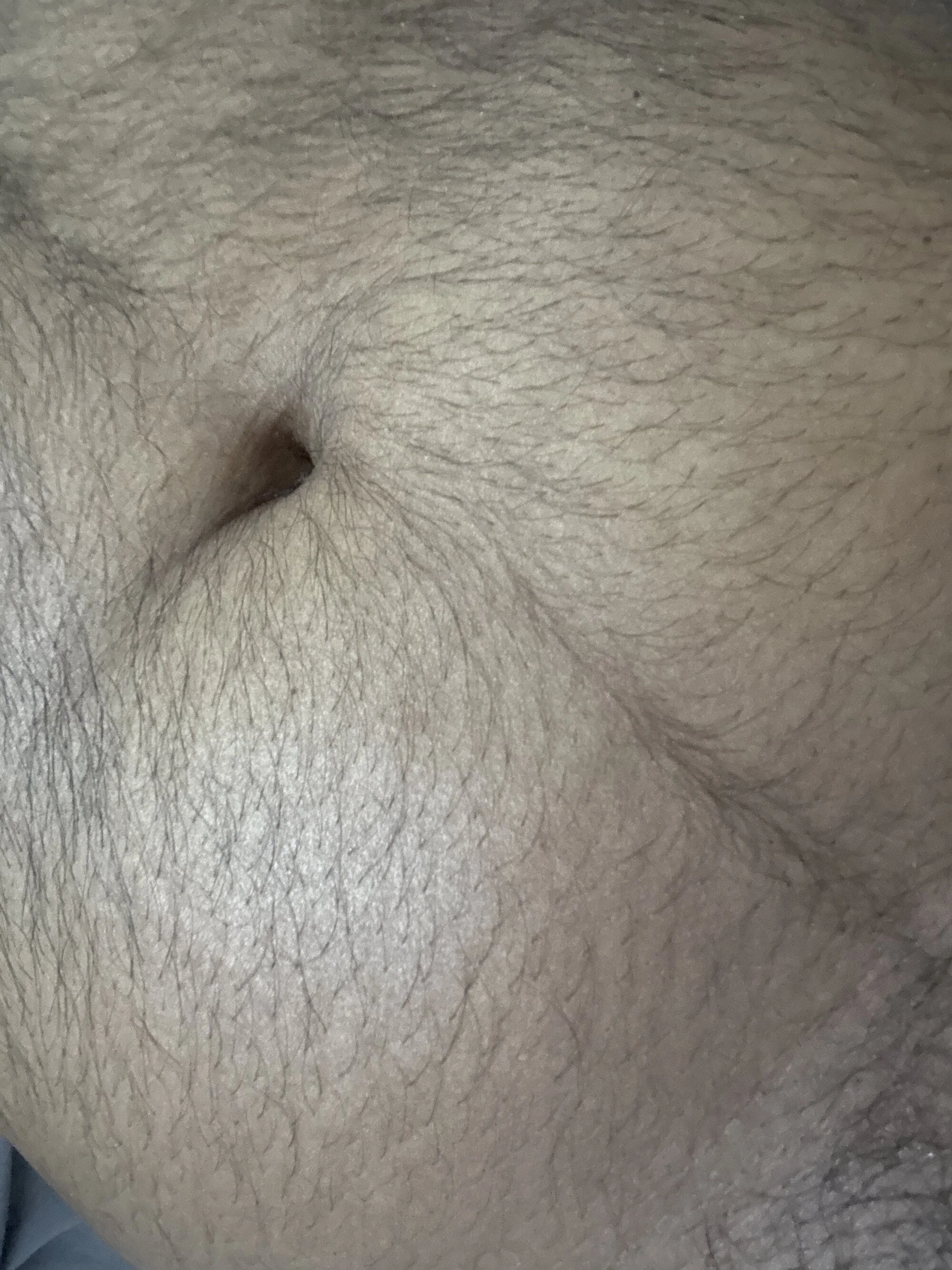 couple-pinky live webcam