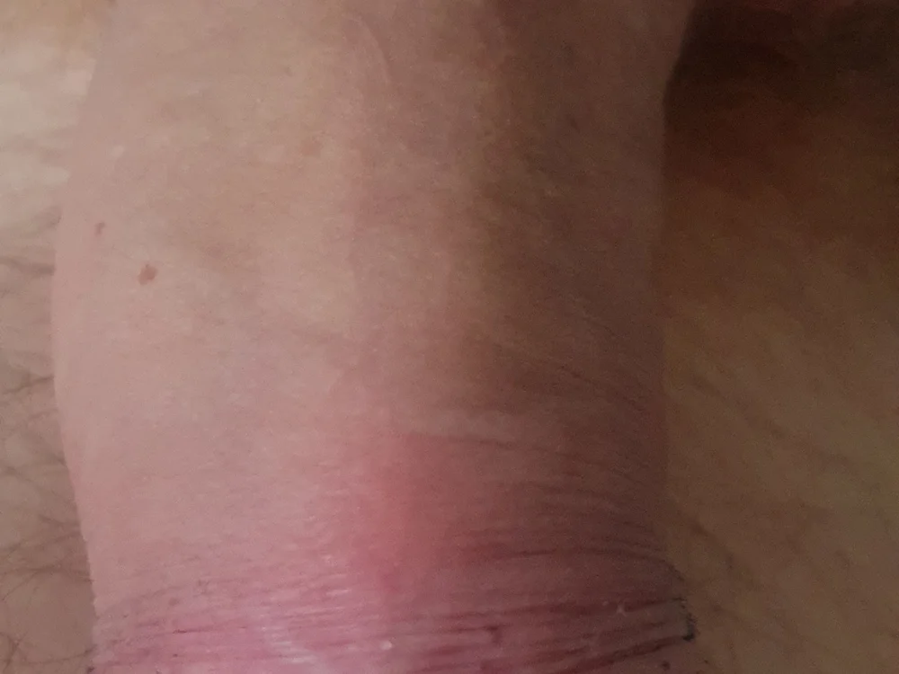 malegrossebite offline chatrum