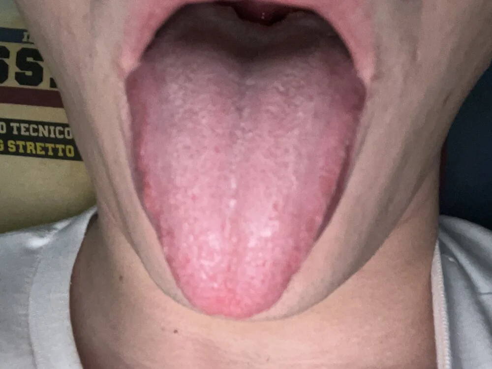 ita03 Offline XXX-chat