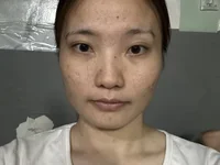 Model Lerxxic