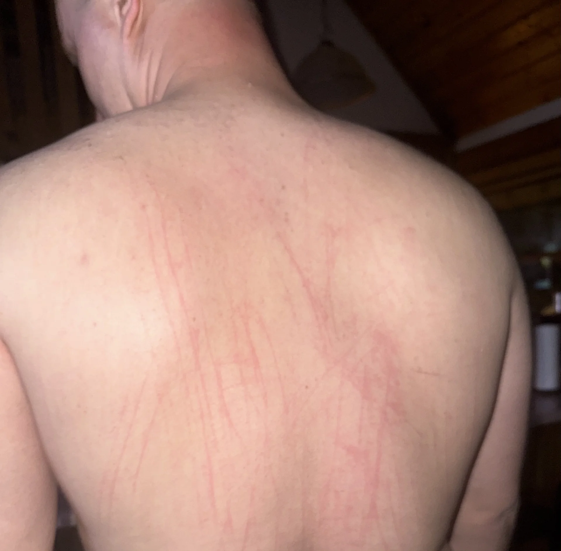 XXX Porn Photo of Nude BugsAndDazey 7