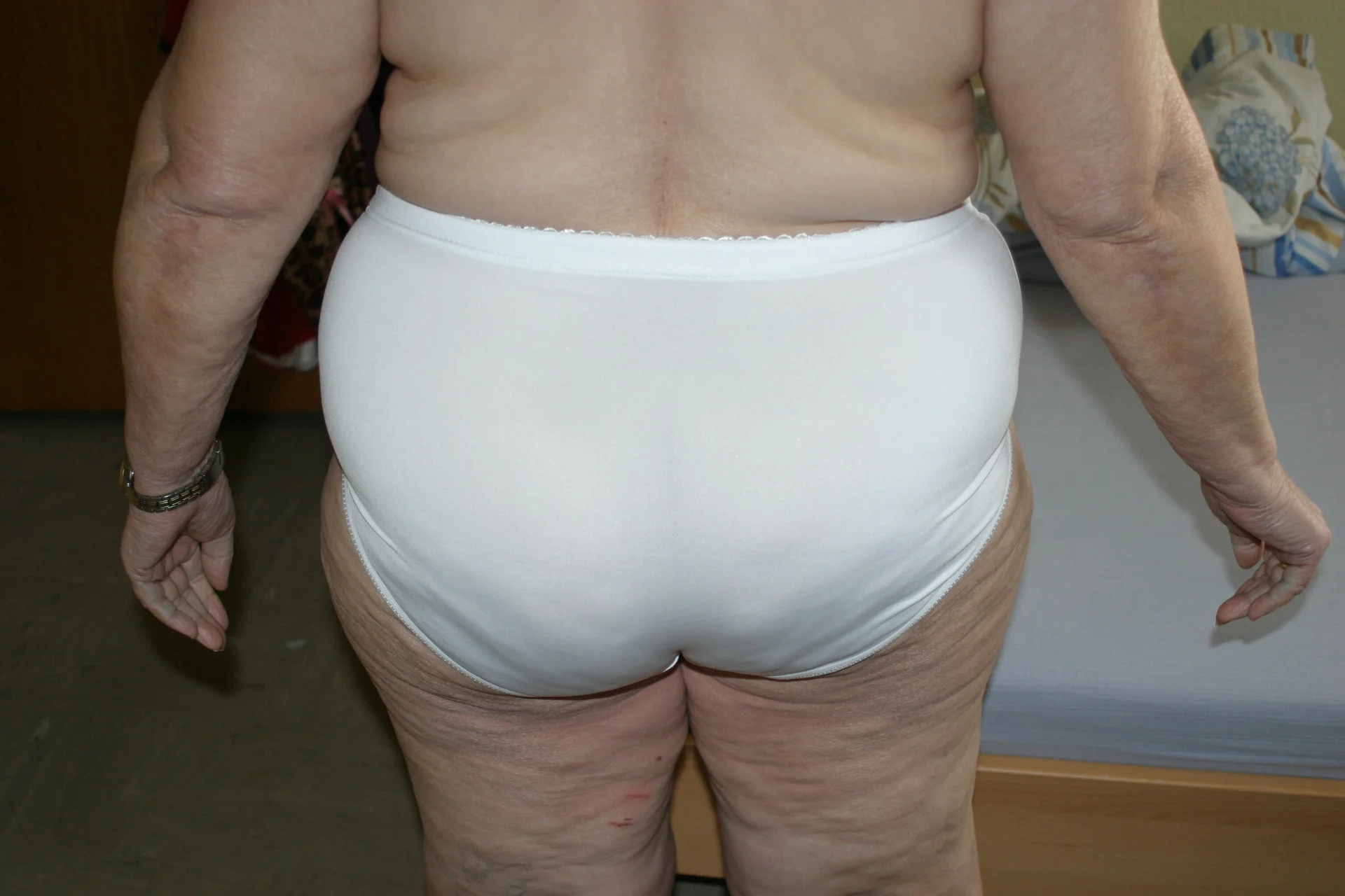 XXX Porn Photo of Nude HeisseomaOriginal 63