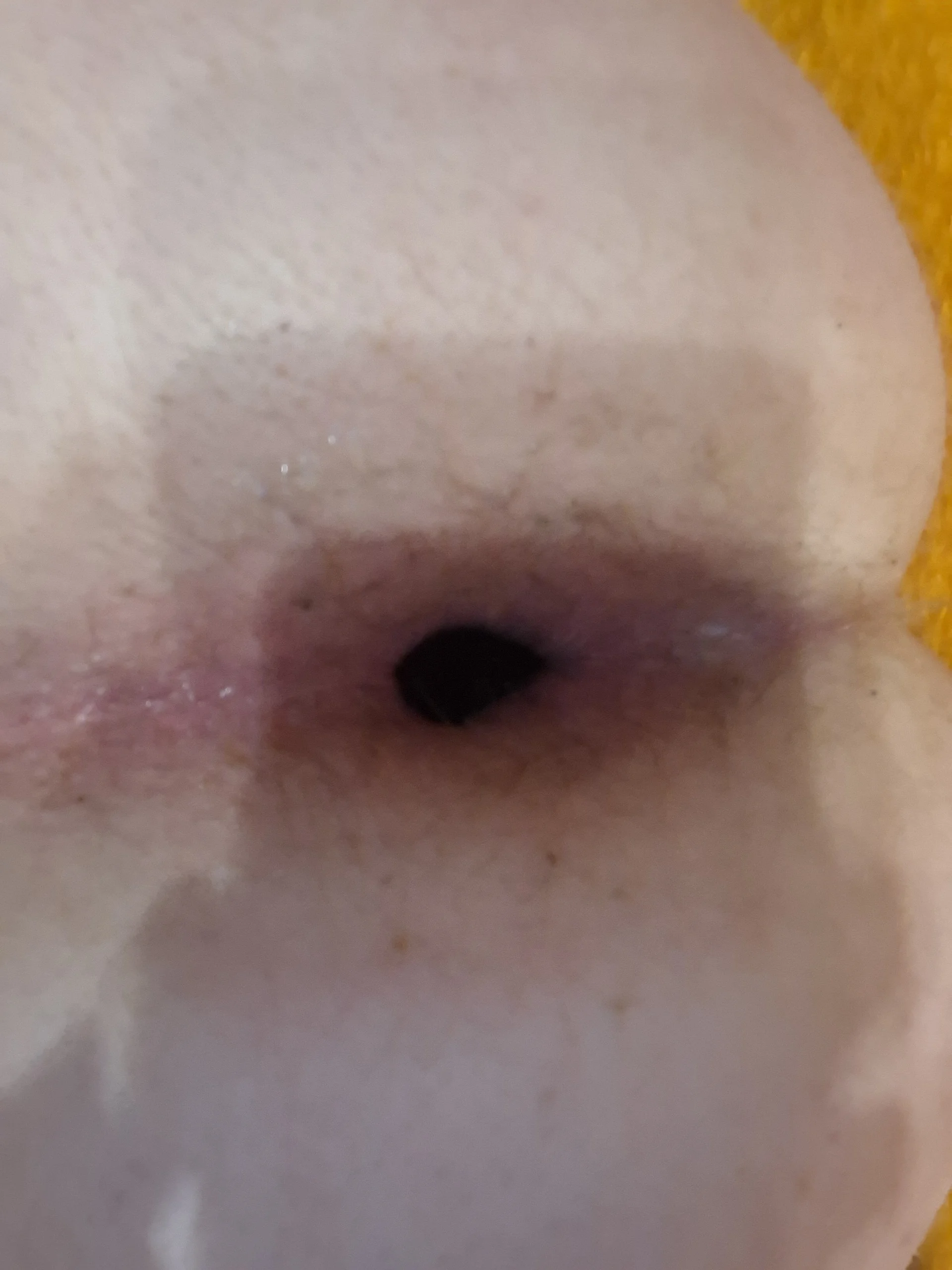 XXX Porn Photo of Nude JupaAnal 2