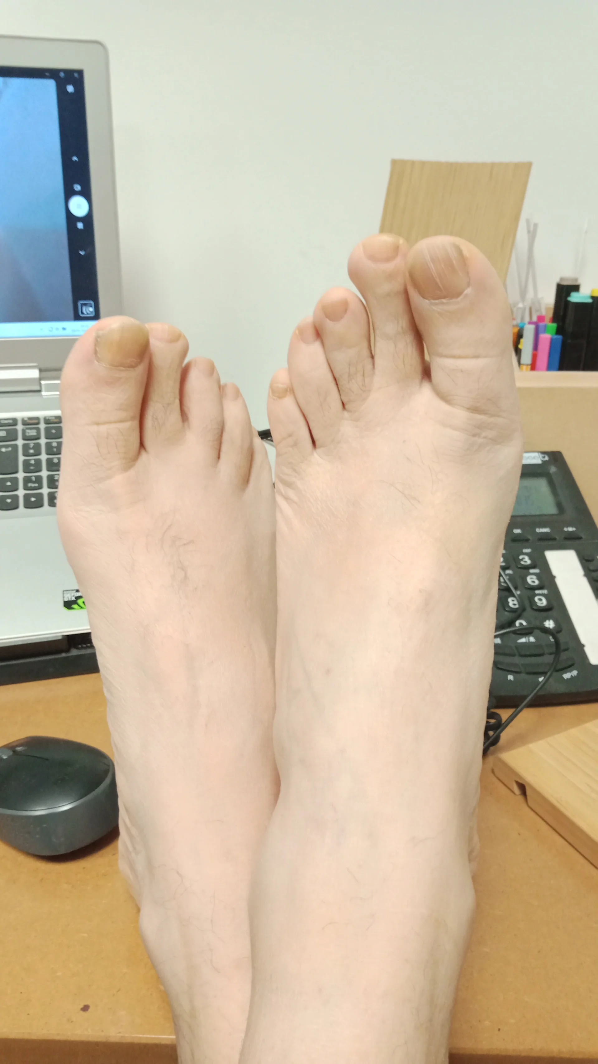 XXX Porn Photo of Nude Cellino4 3