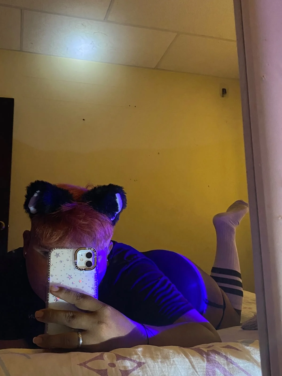 XXX Porn Photo of Nude rabbitplayboy19 3