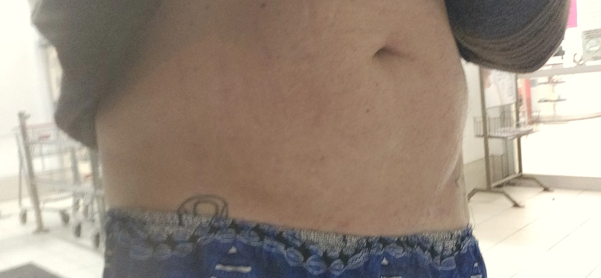XXX Porn Photo of Nude BulbasaurIsmettv 5