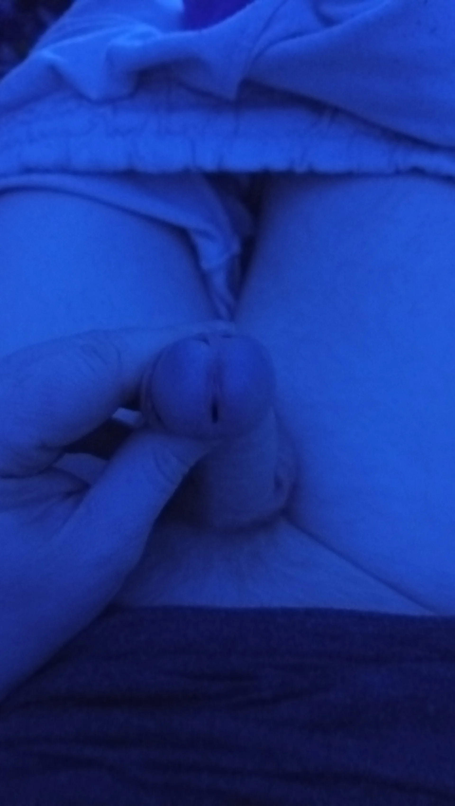 XXX Porn Photo of Nude MyBeautifulOneOnlyPenis 1