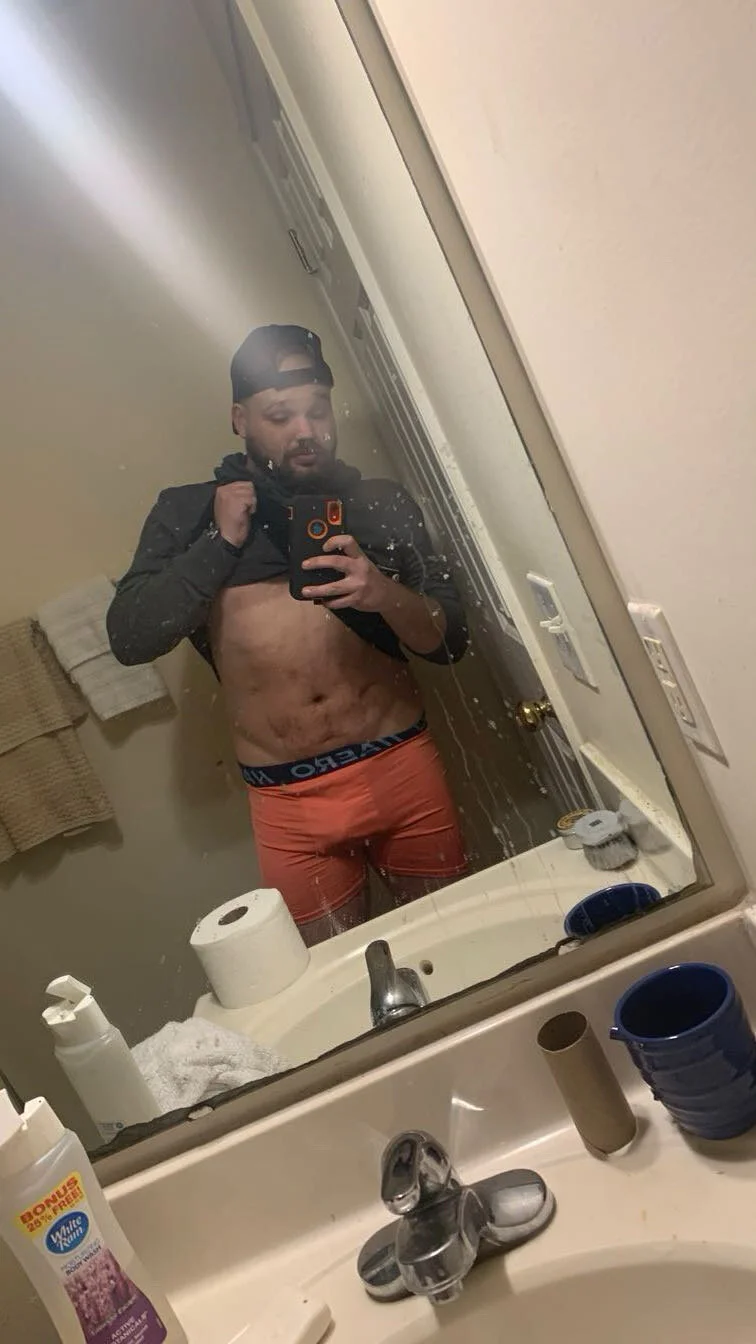 XXX Porn Photo of Nude Xstumpy 3