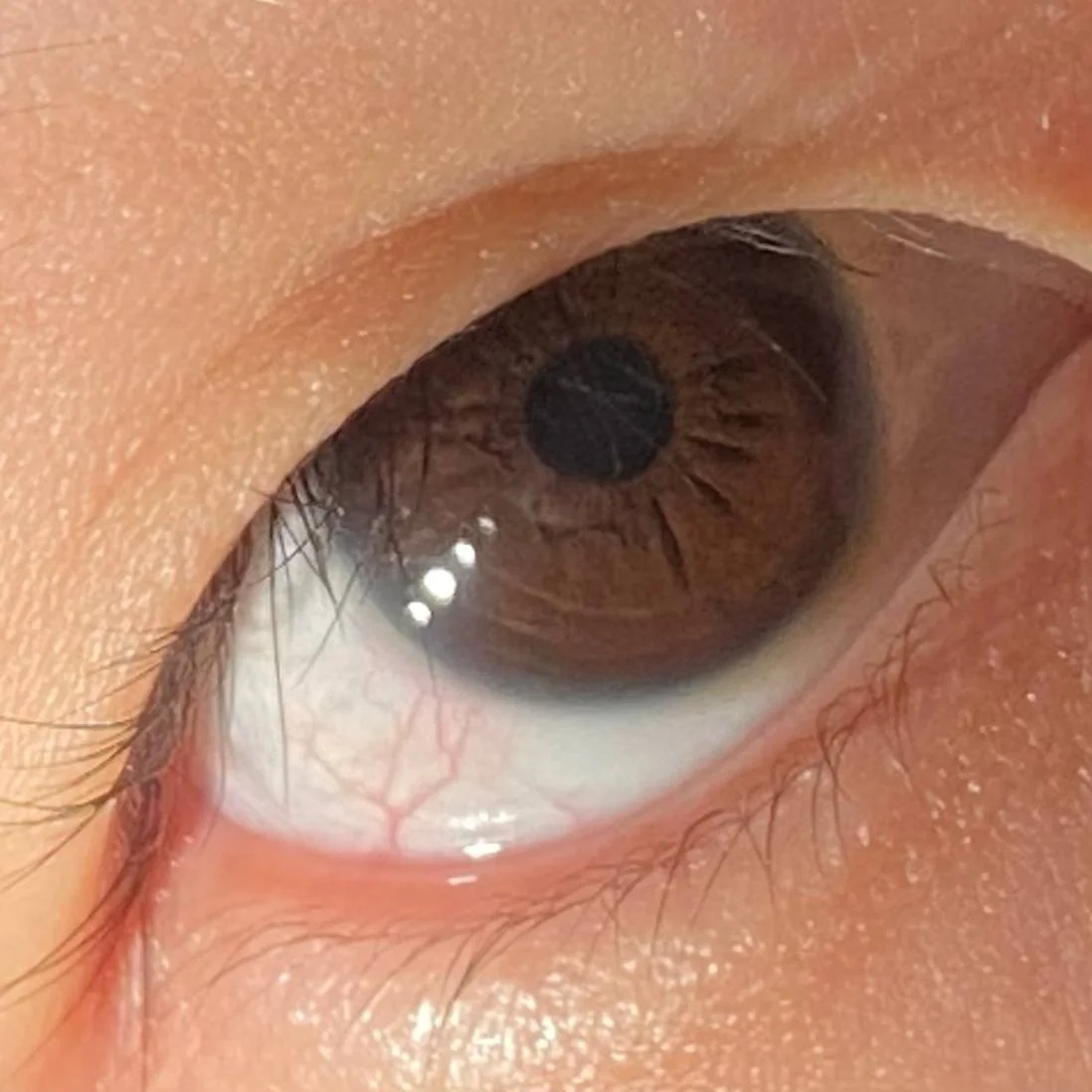 oohannii