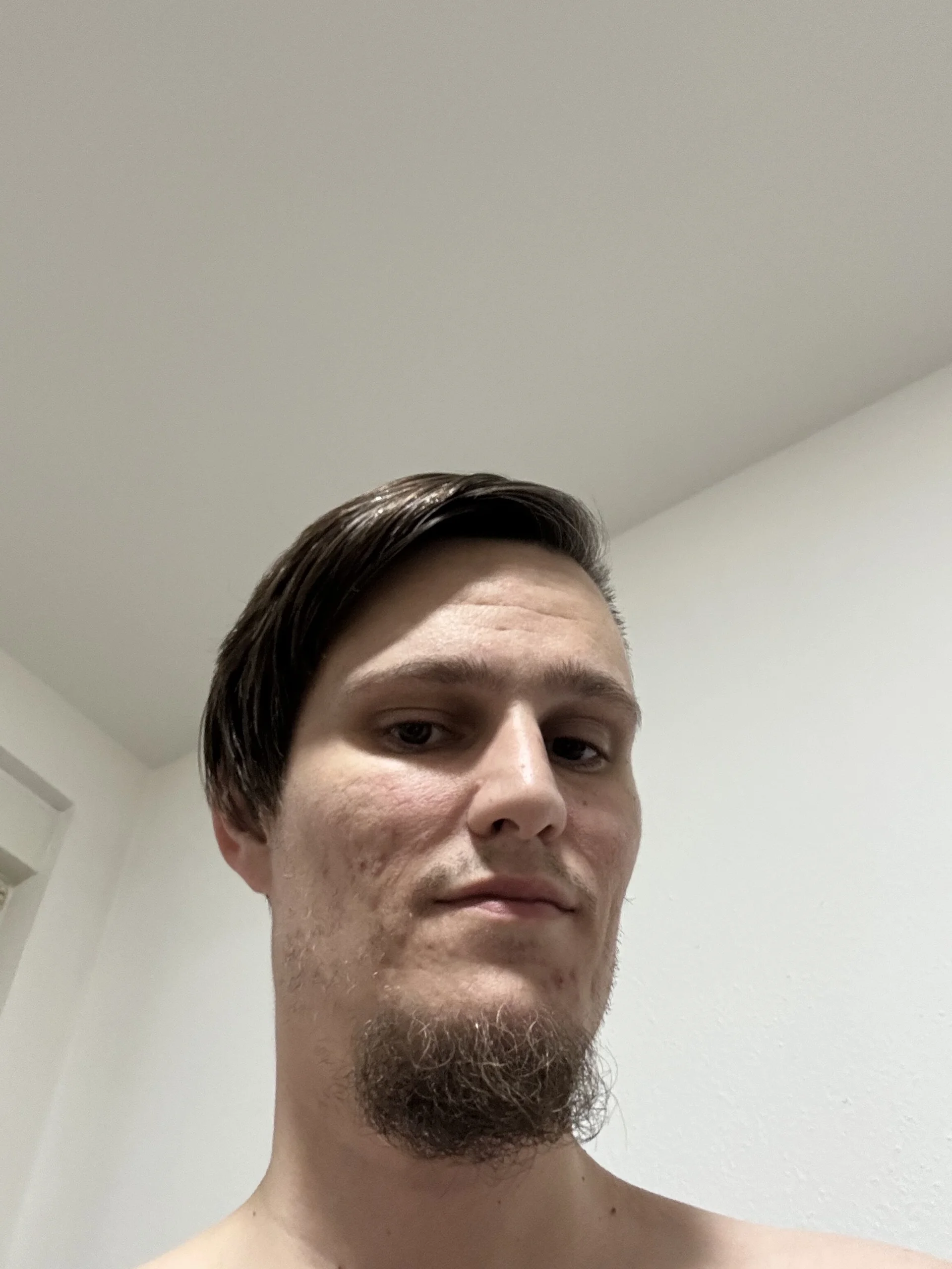 XXX Porn Photo of Nude OhneGummiKleveReal 3
