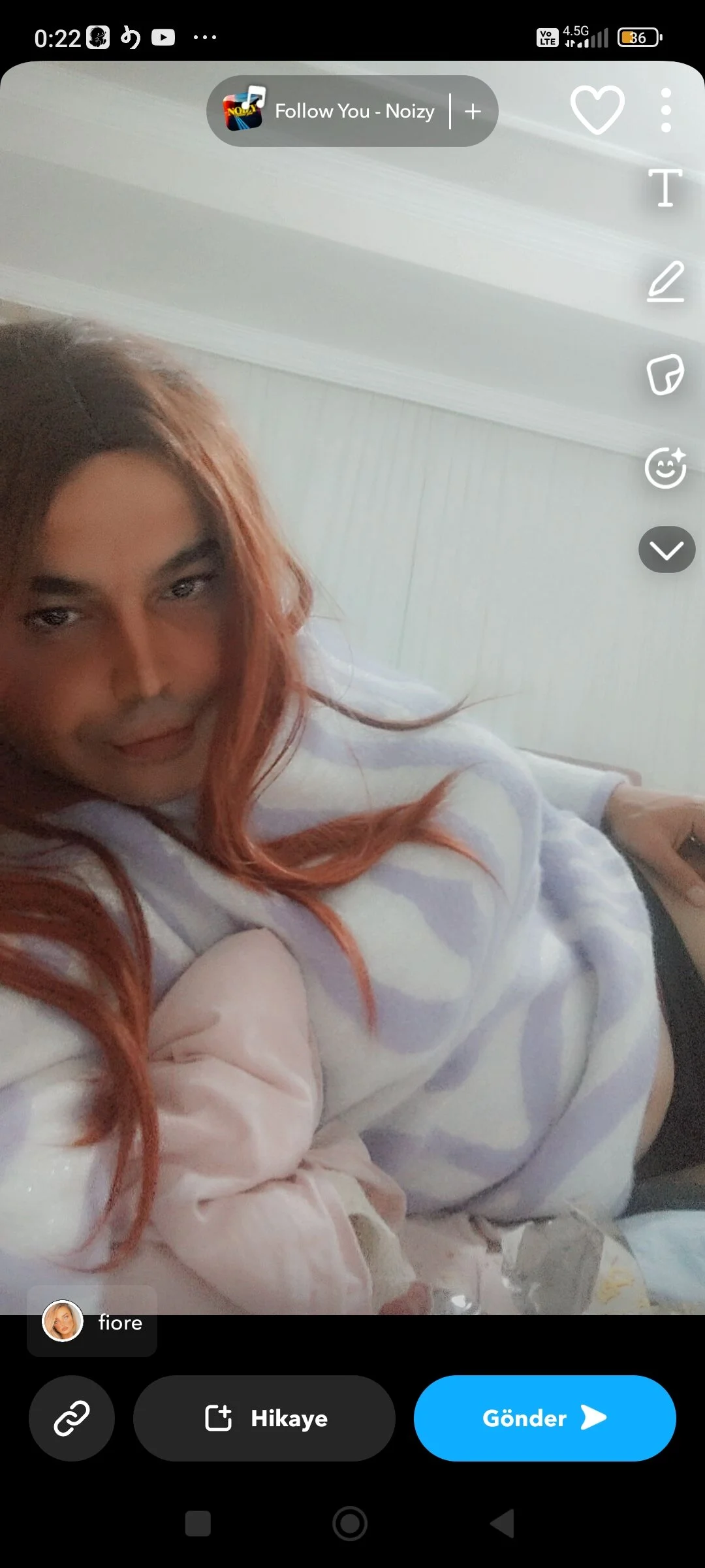 XXX Porn Photo of Nude Ilkaysu666 15