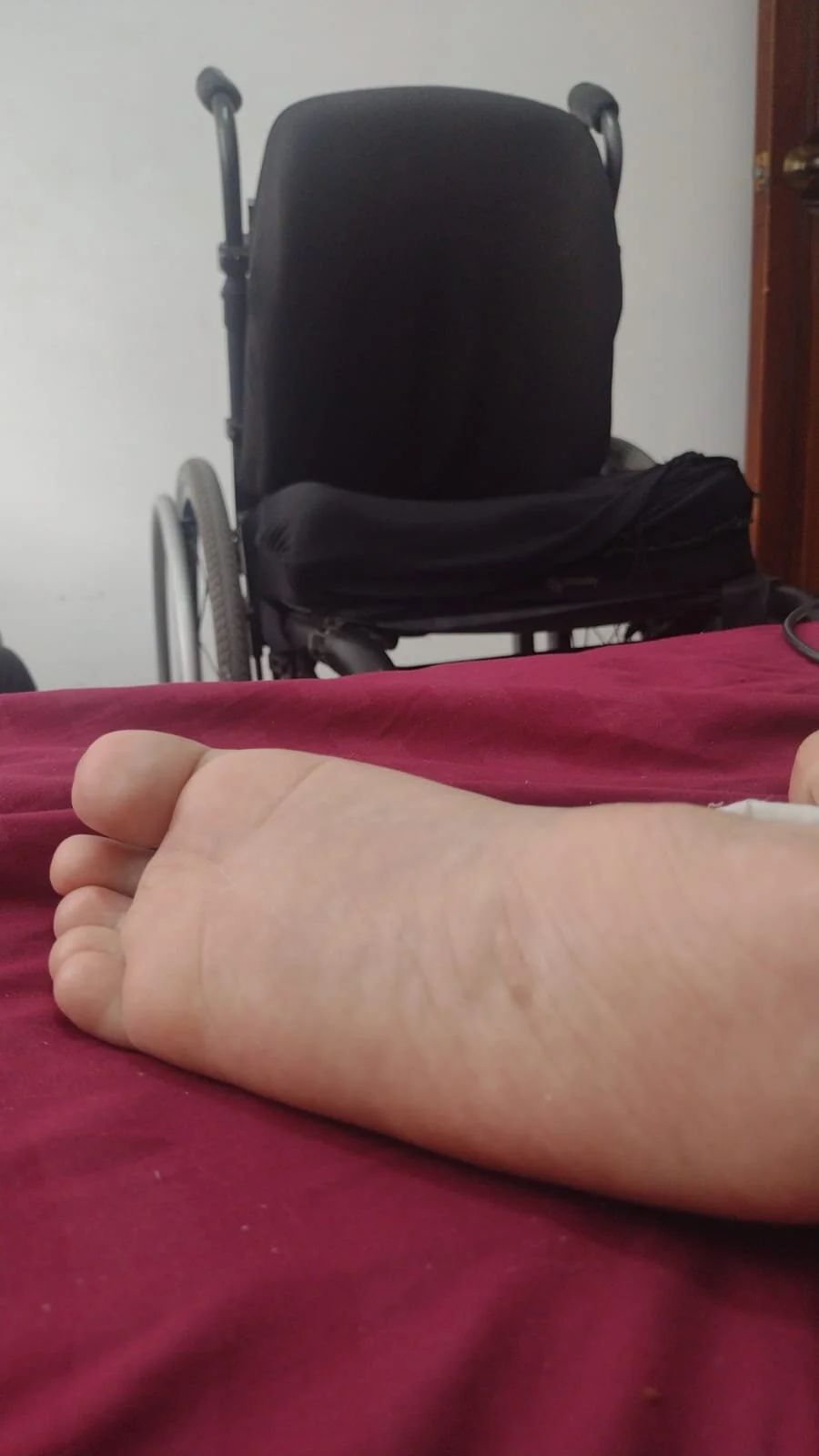 XXX Porn Photo of Nude handicappedsex 5