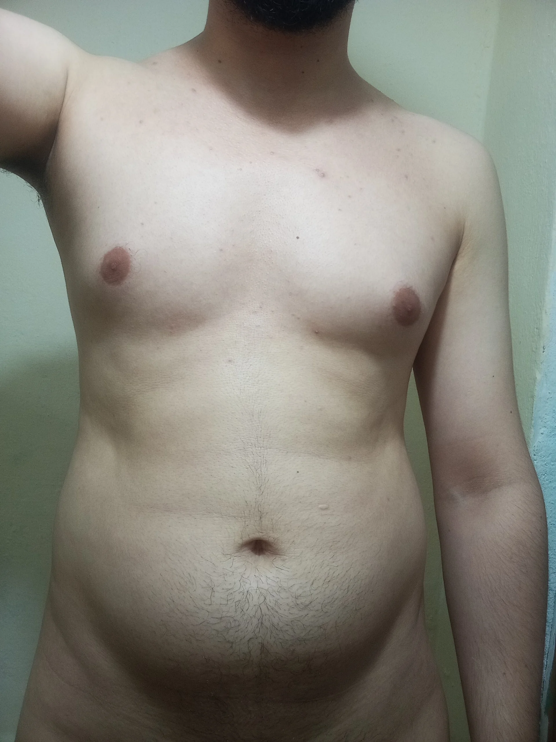 XXX Porn Photo of Nude PottedKetosis 3