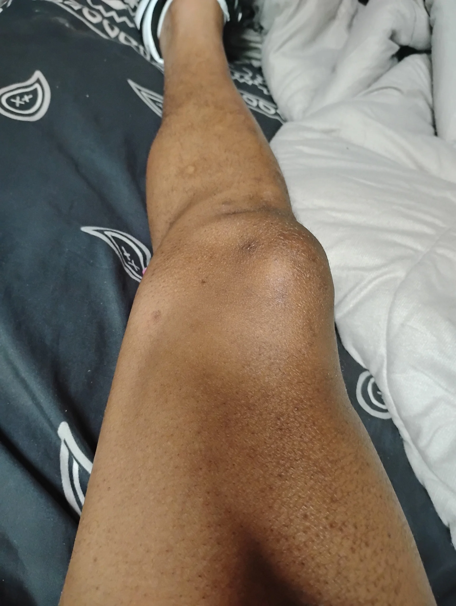 XXX Porn Photo of Nude BrownSkinGuy420 2
