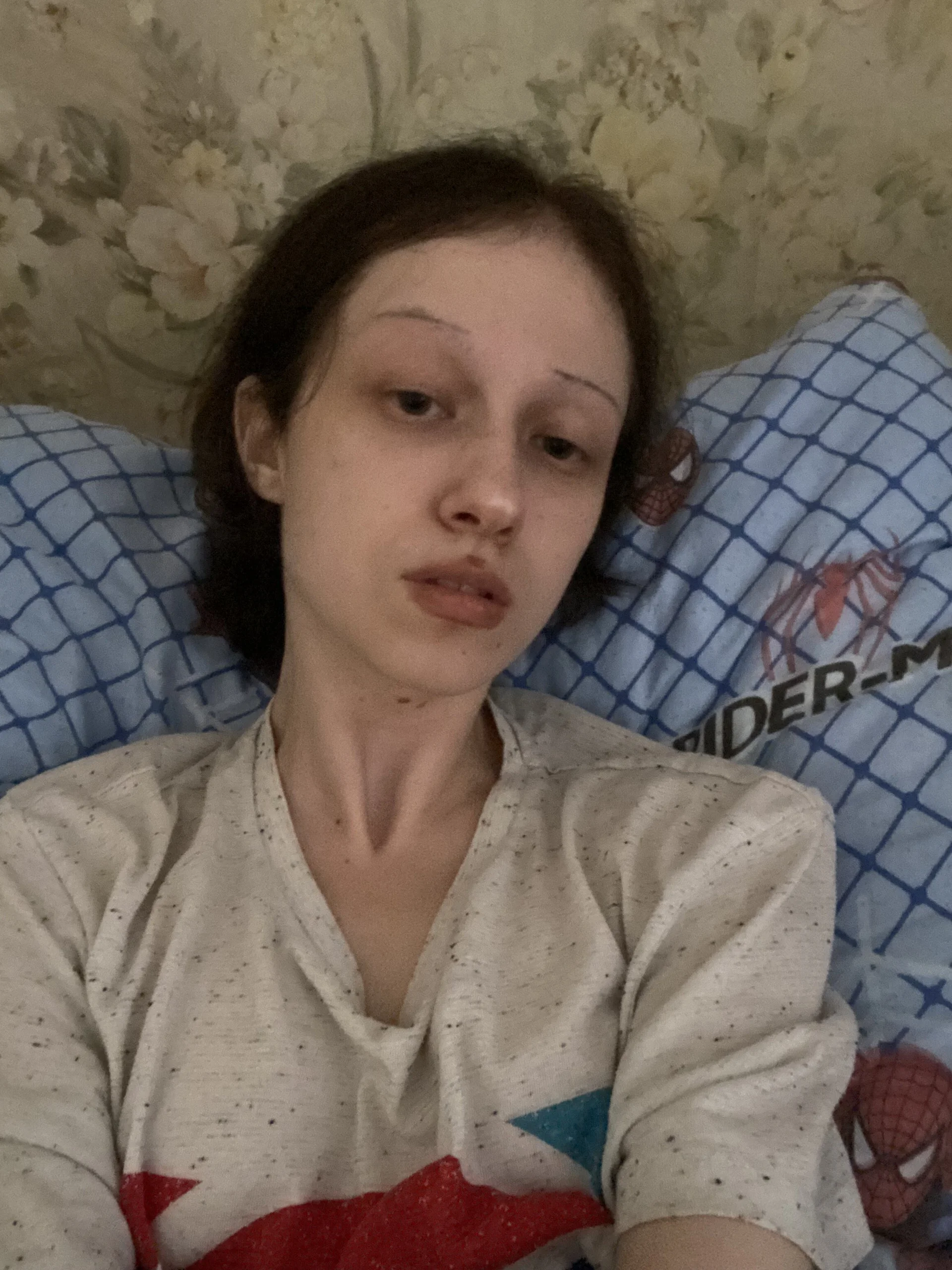 XXX Porn Photo of Nude demoxepam 15