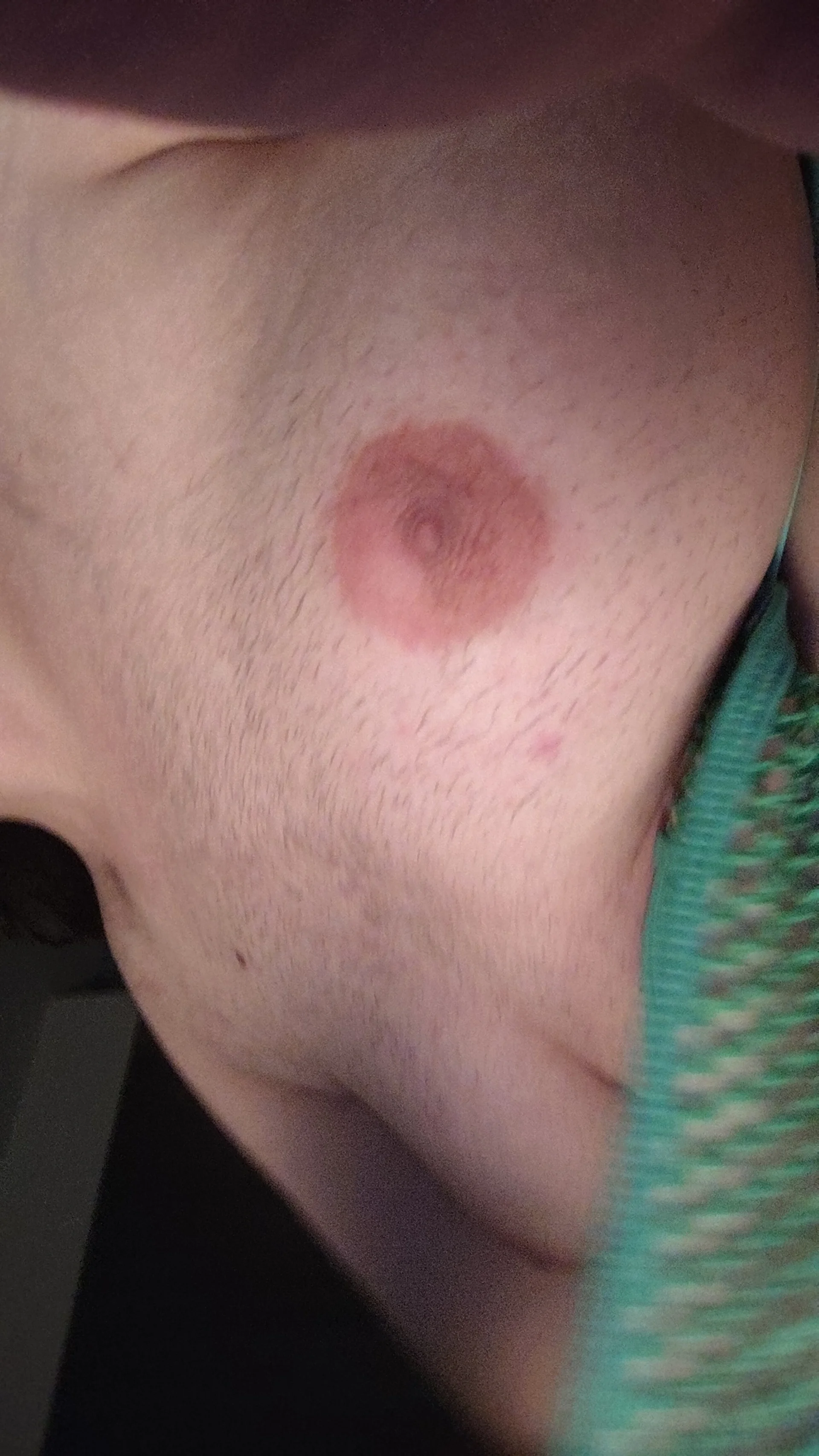 XXX Porn Photo of Nude Analboy20anal 13