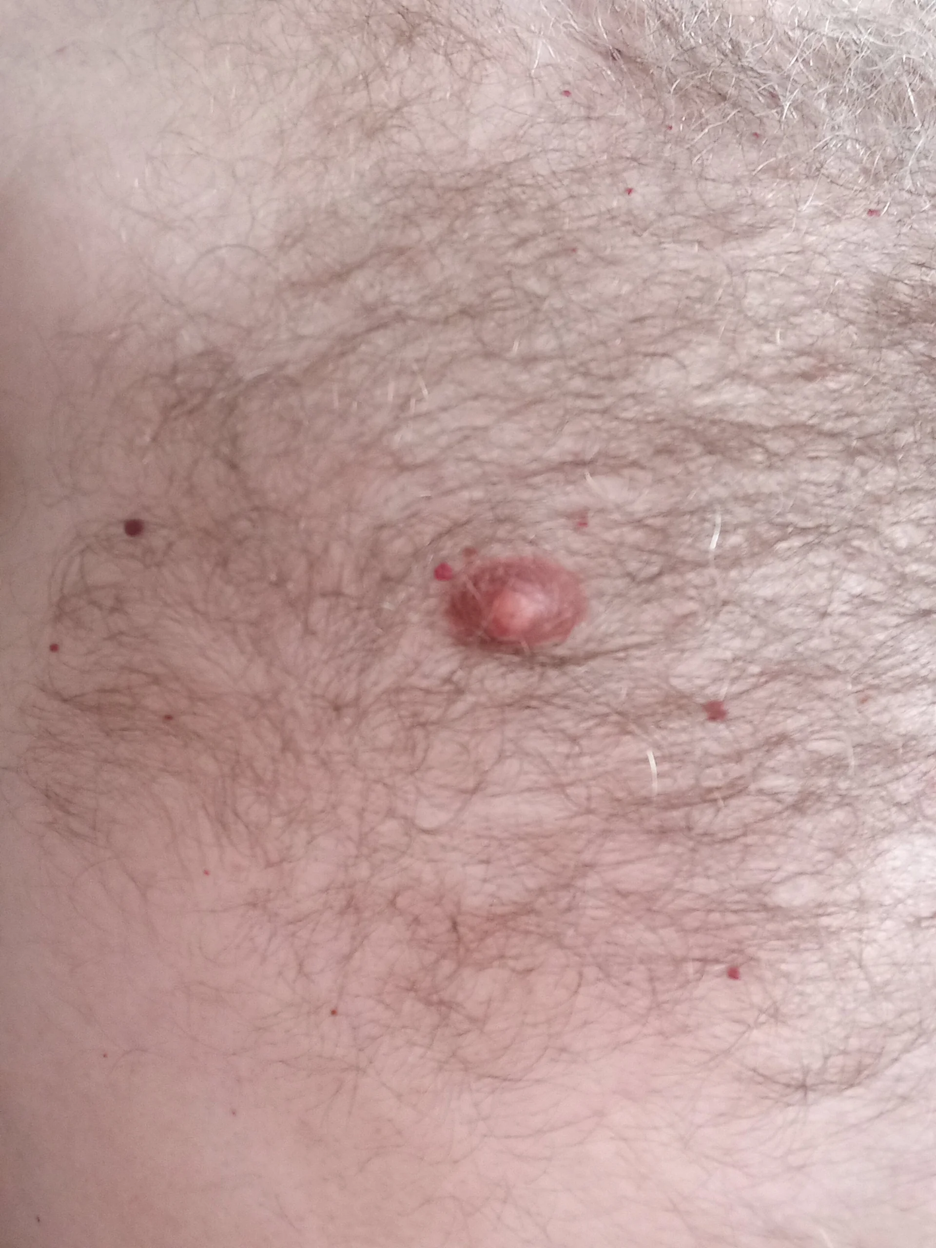 XXX Porn Photo of Nude schlueppee64 1