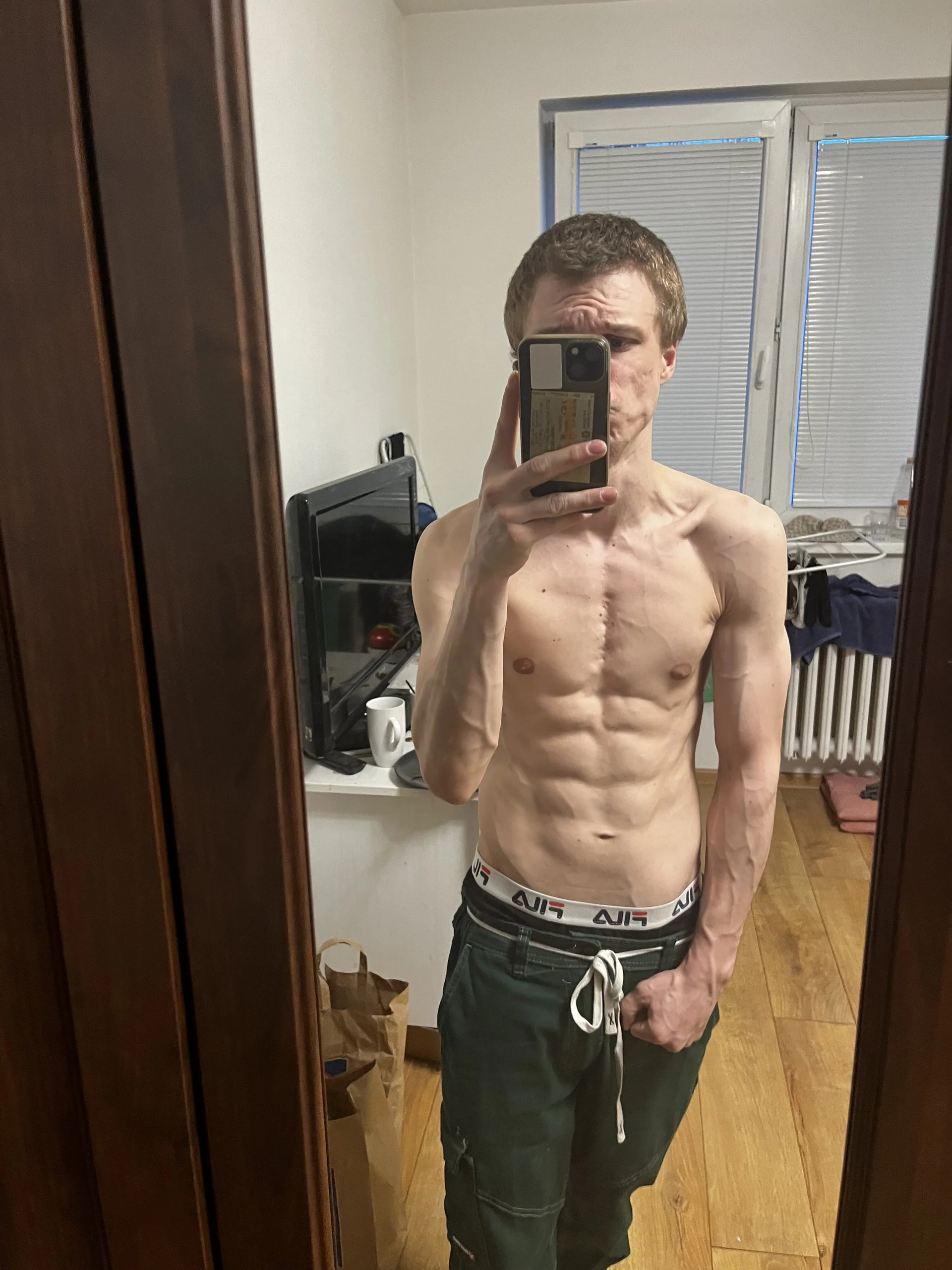 XXX Porn Photo of Nude medikuan 1