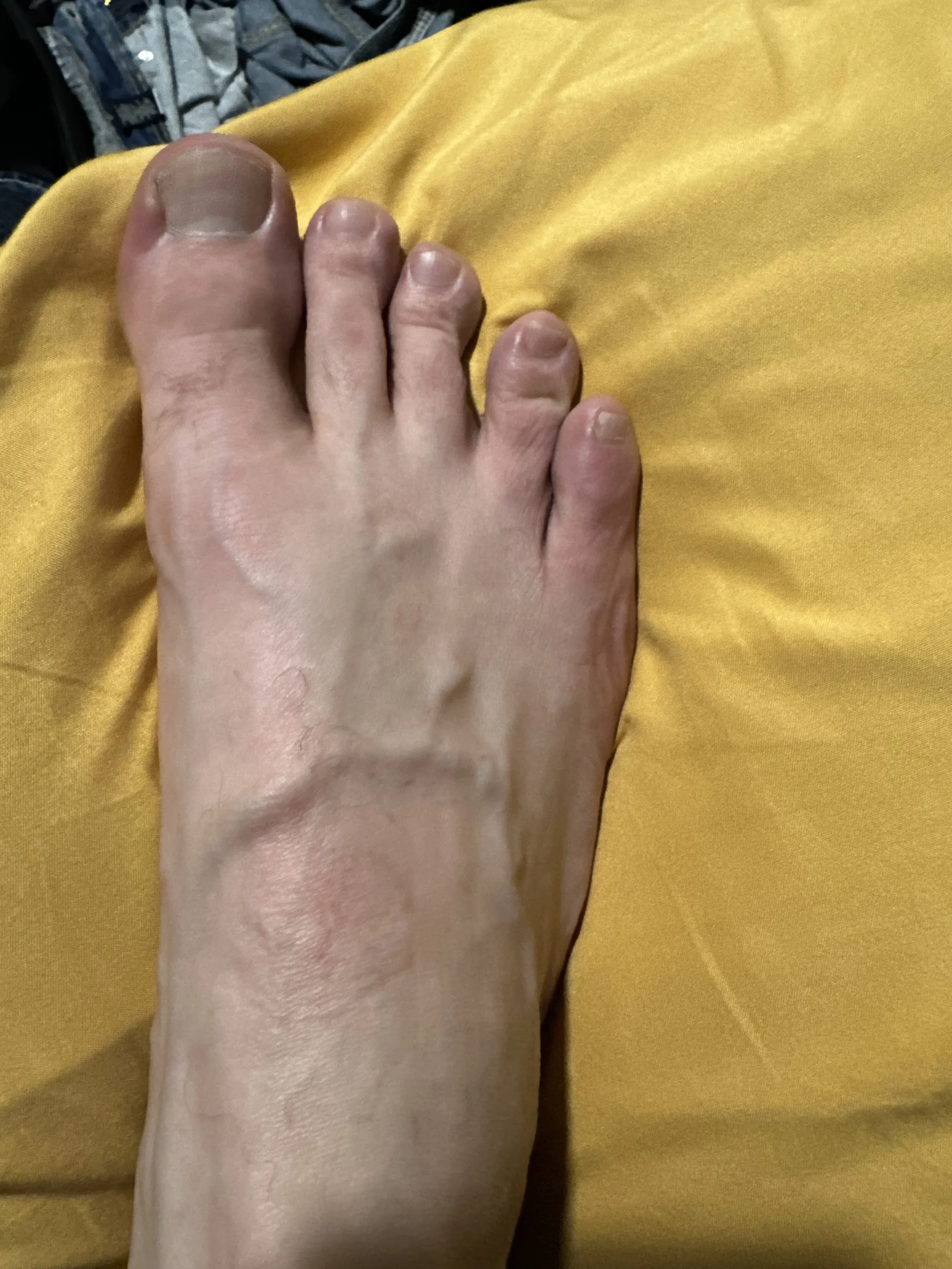 XXX Porn Photo of Nude Tentoes4bros 5
