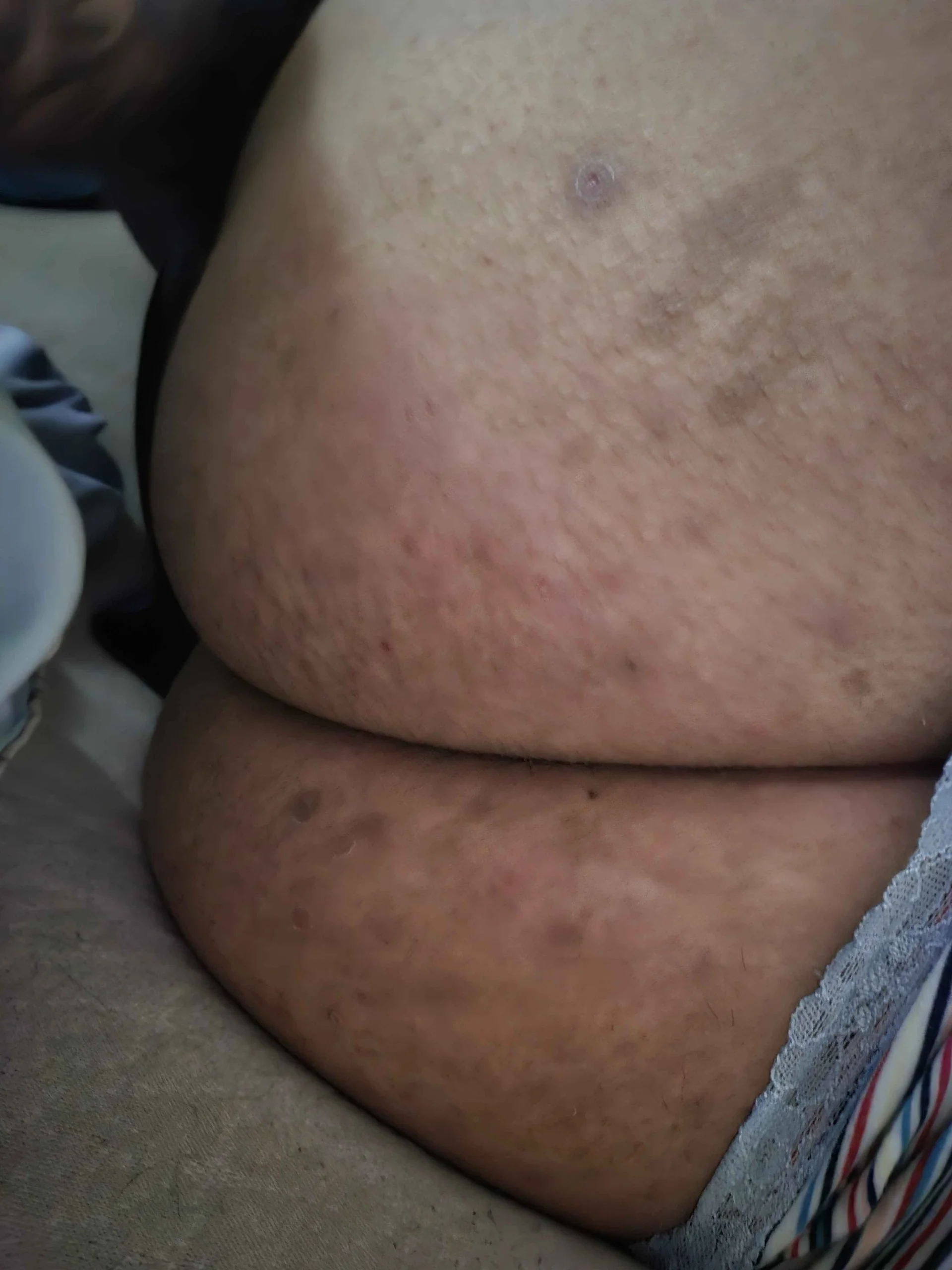 XXX Porn Photo of Nude LuxBenn 5