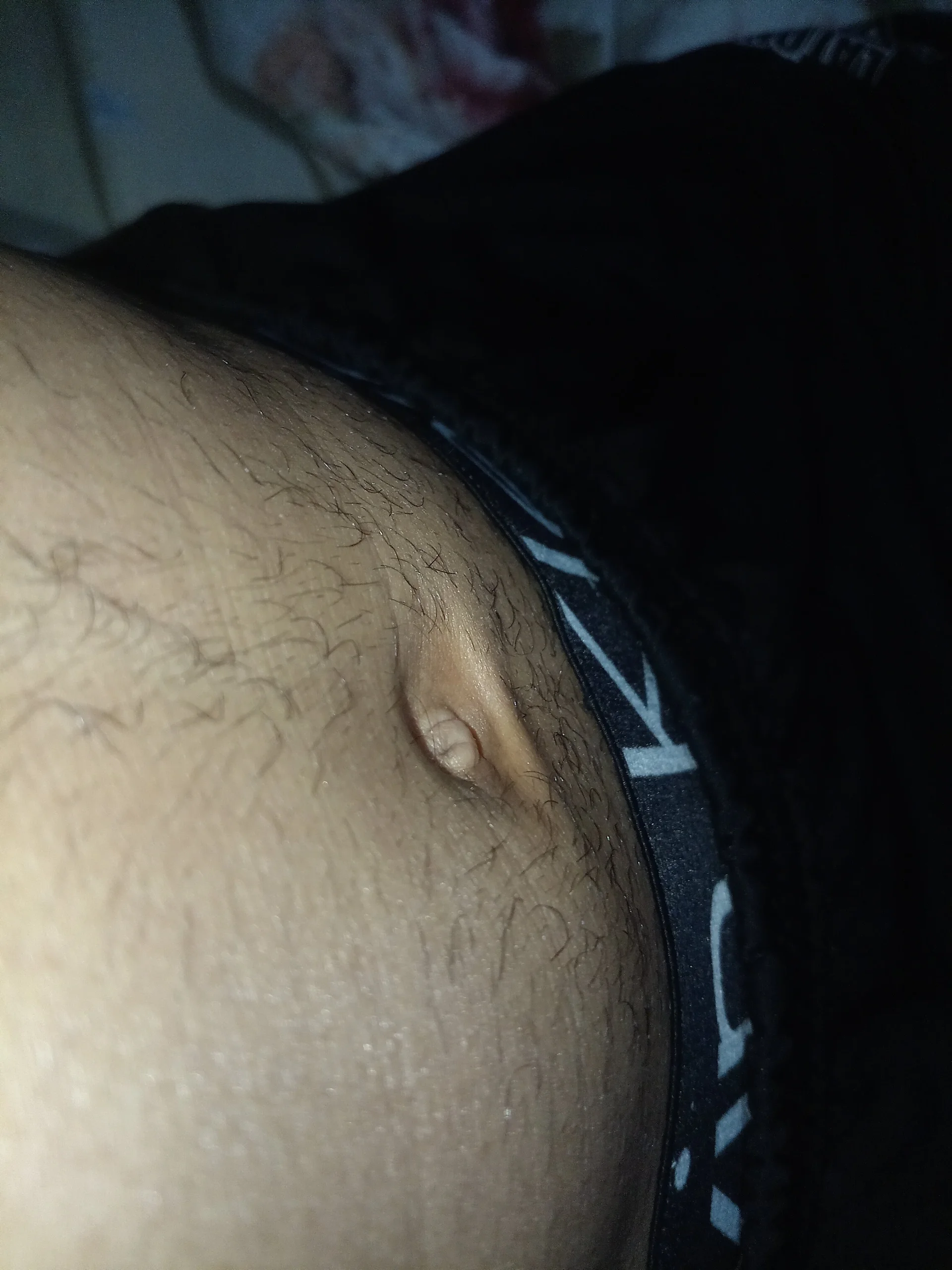XXX Porn Photo of Nude MikeDollsFlower 5