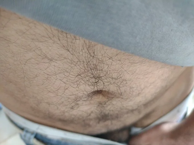 XXX Porn Photo of Nude XDhyro 1