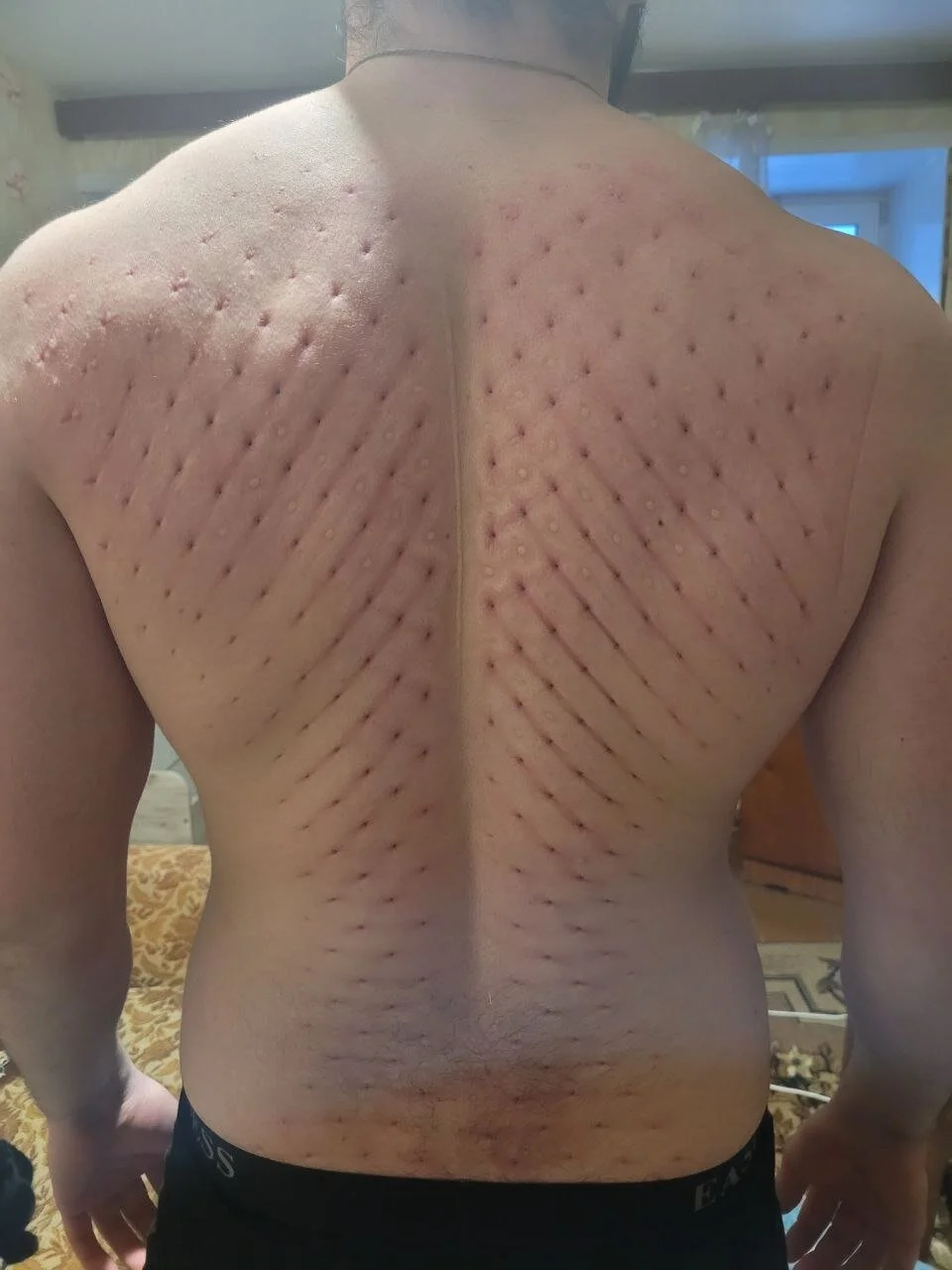 XXX Porn Photo of Nude Ant_Power 39