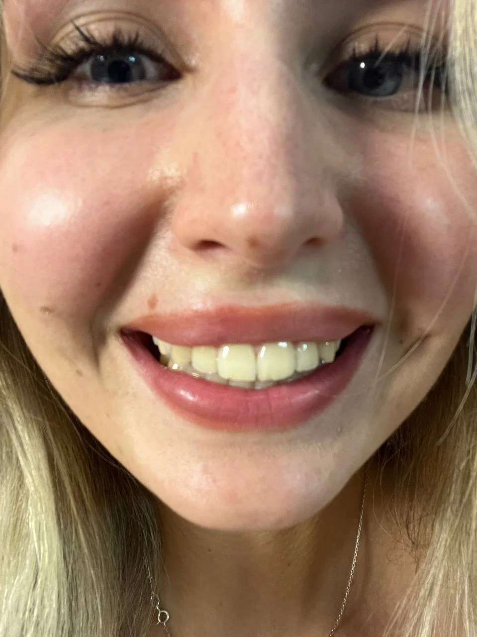 XXX Porn Photo of Nude coldcherryeclipse_ 9