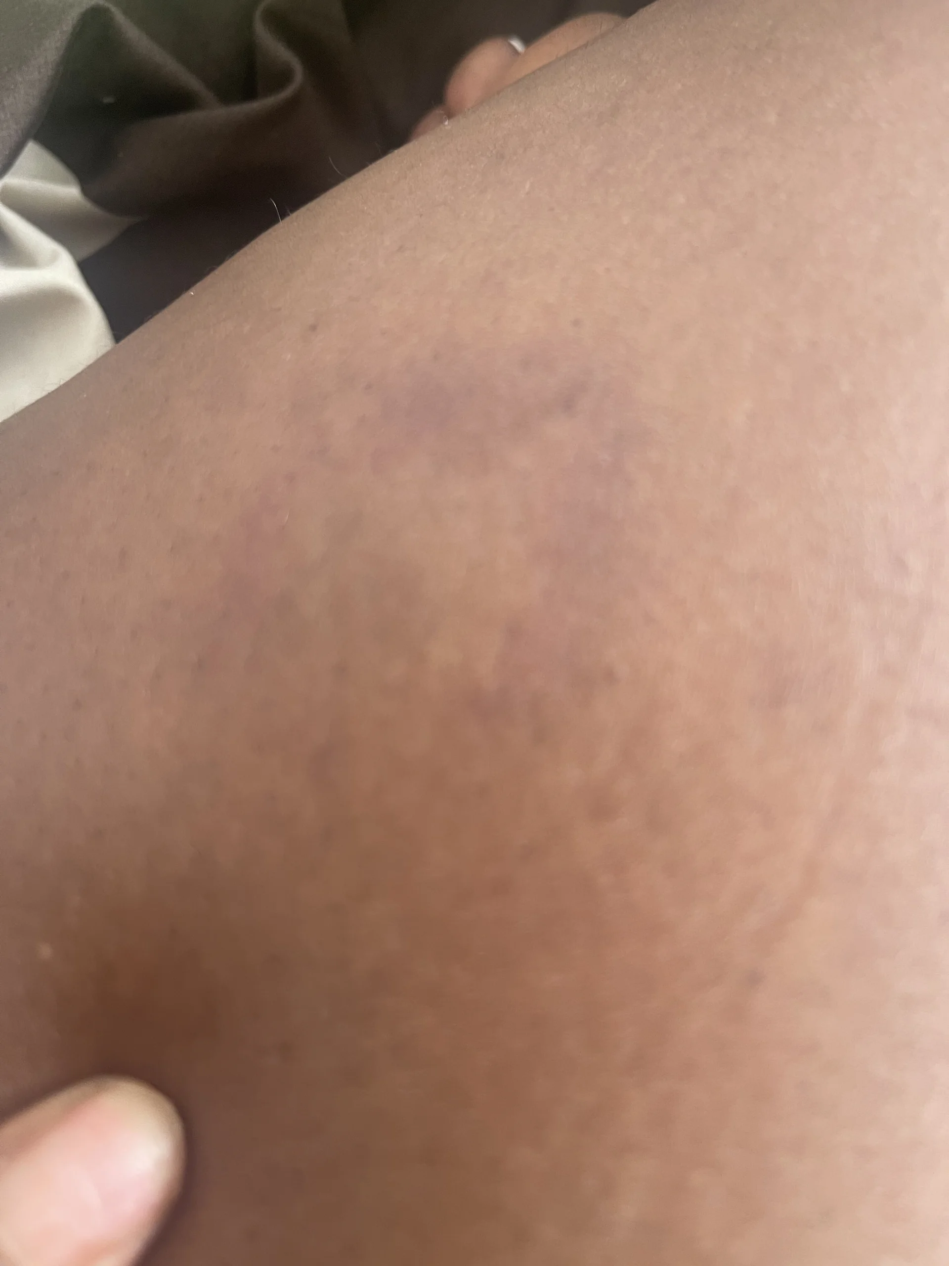 XXX Porn Photo of Nude Cherishcherrysha 7