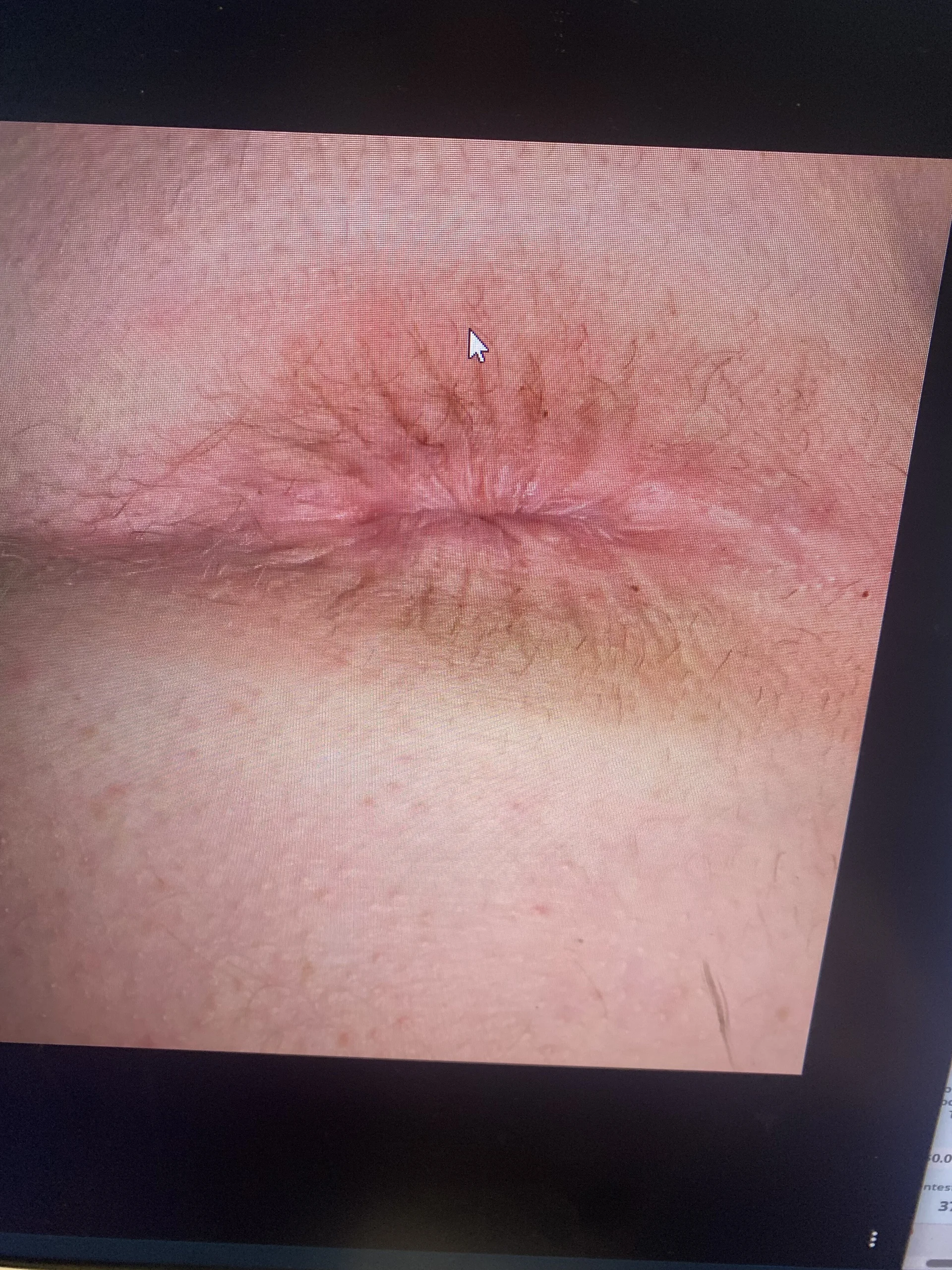 XXX Porn Photo of Nude purelovexx 8