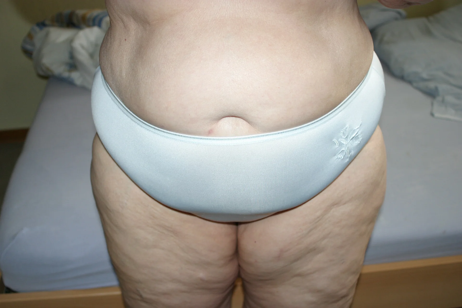 XXX Porn Photo of Nude HeisseomaOriginal 40