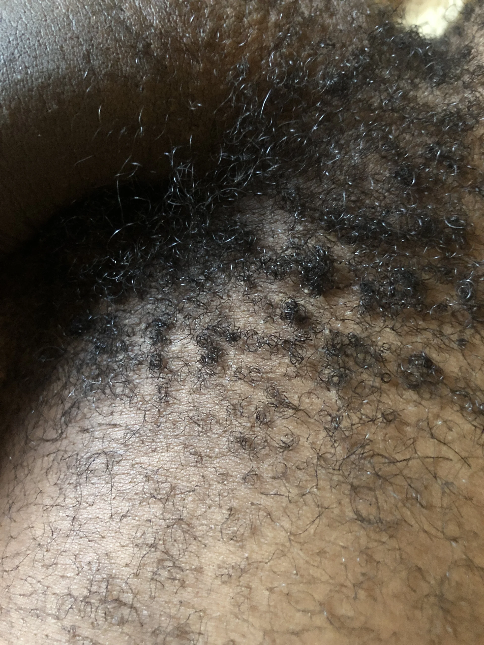 XXX Porn Photo of Nude MzansiMonster 3