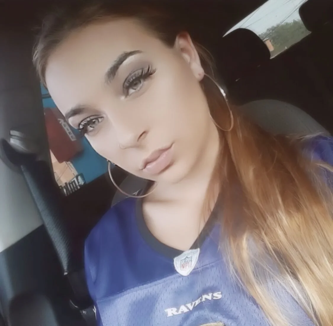 XXX Porn Photo of Nude Fkknspoiledbrat 3