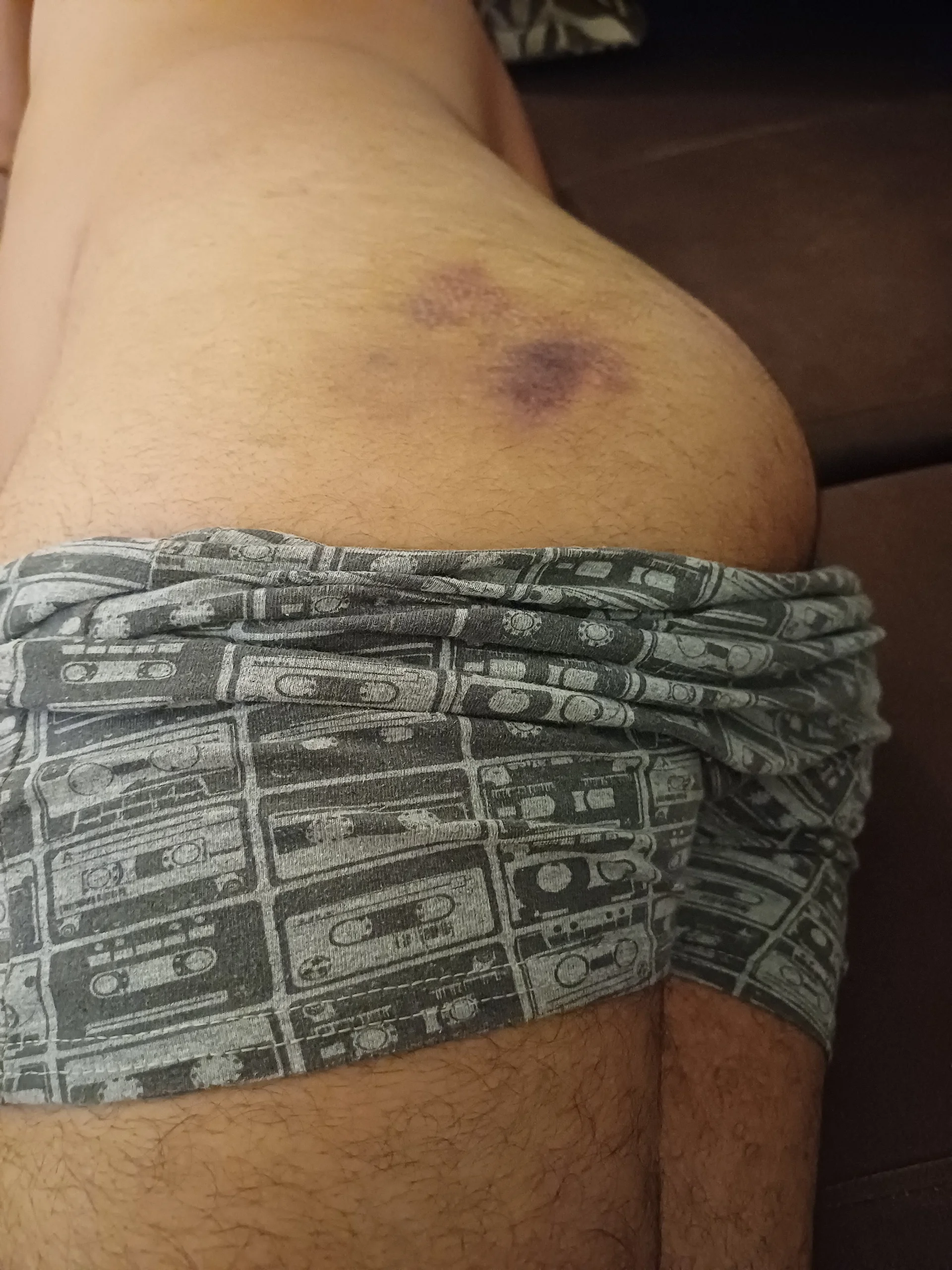 XXX Porn Photo of Nude anderson1003xv 2
