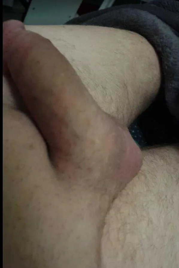 XXX Porn Photo of Nude Lovyourpuss 2