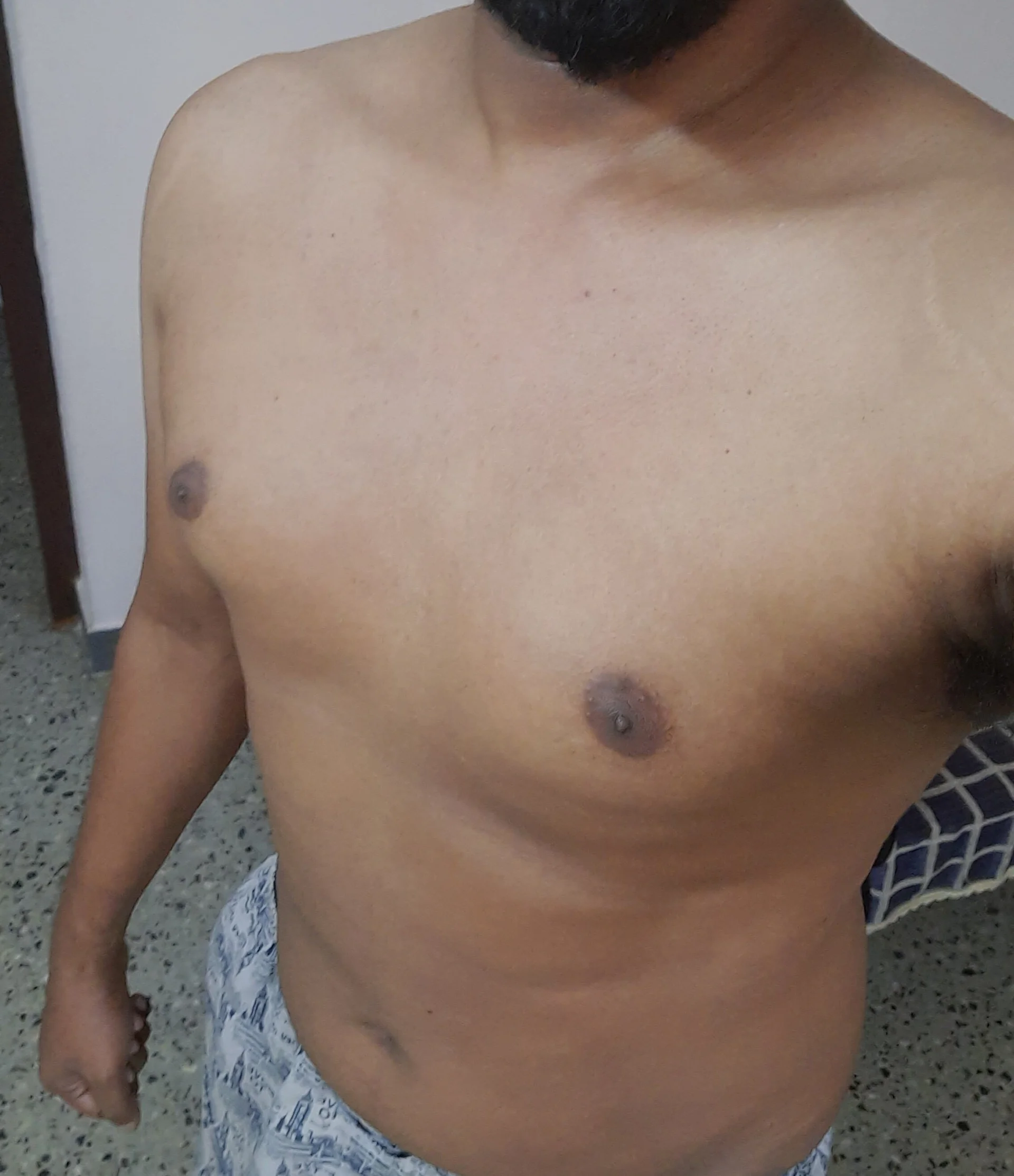 XXX Porn Photo of Nude Rohitsacharya 2