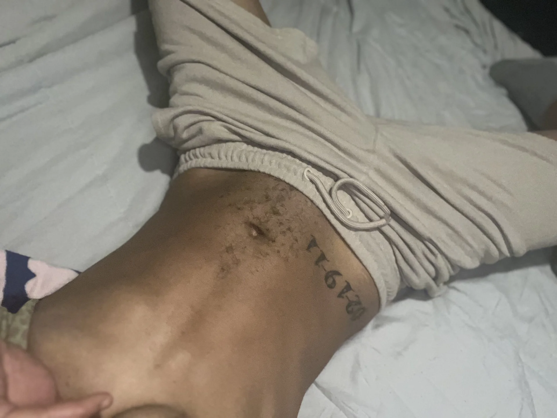 XXX Porn Photo of Nude PHAT_FTM_KLIT87 18
