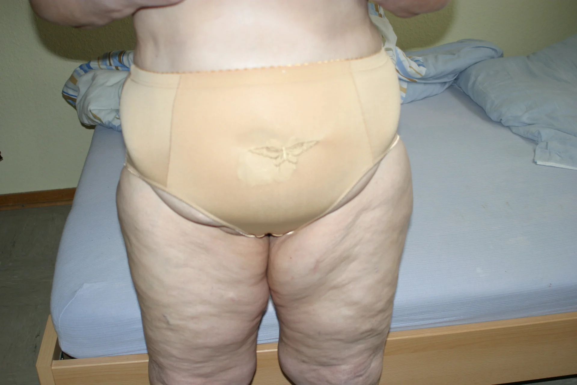 XXX Porn Photo of Nude HeisseomaOriginal 57