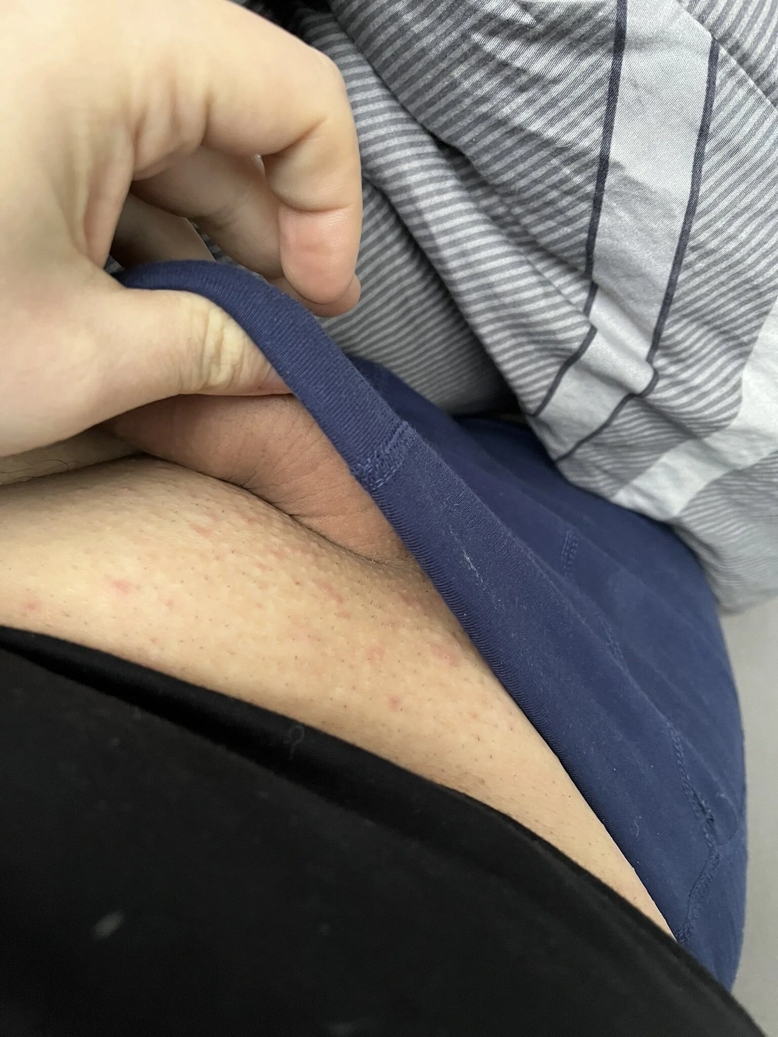 XXX Porn Photo of Nude GlitzerGlitzer 6