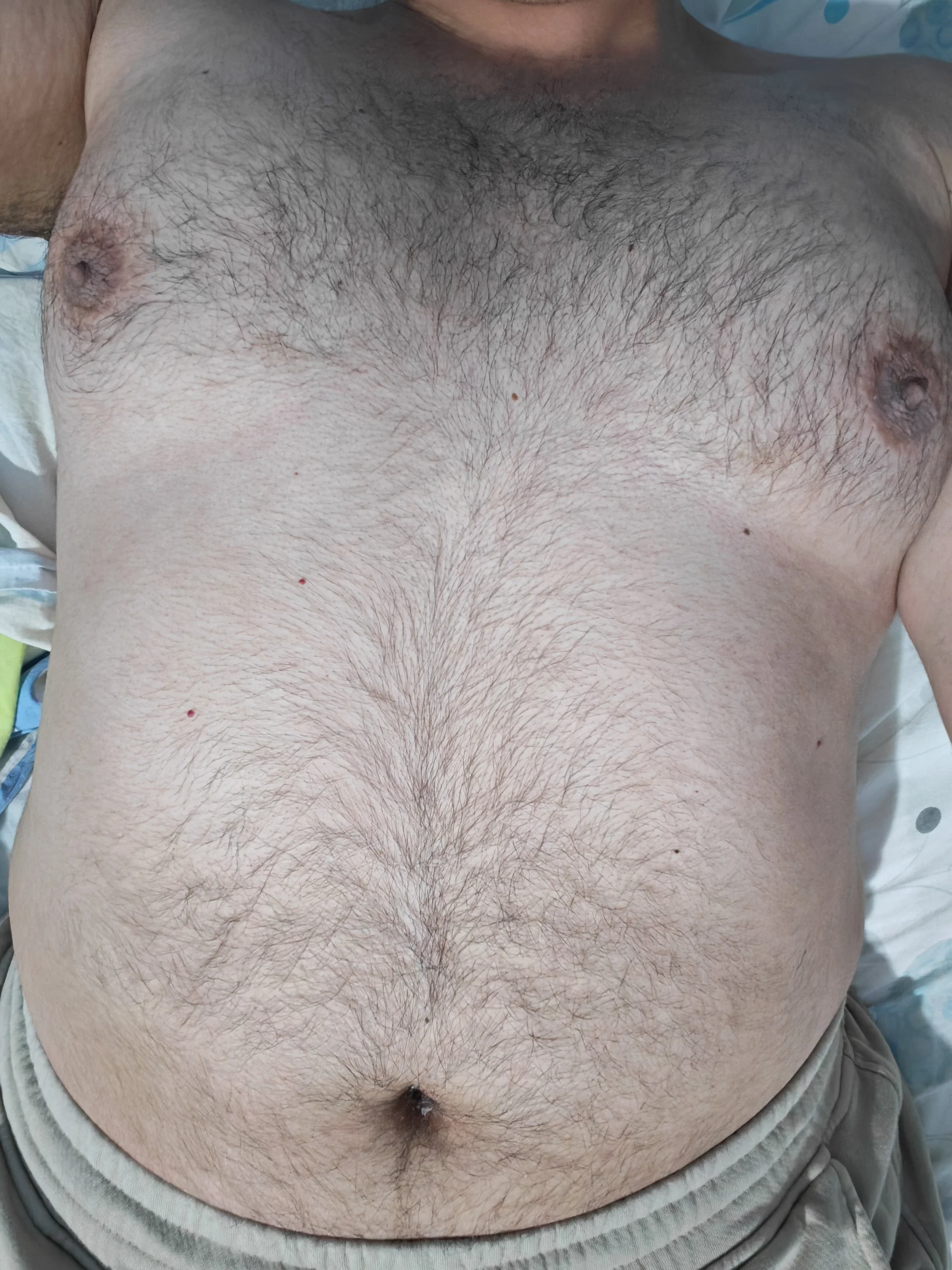 XXX Porn Photo of Nude SickUnity79 3