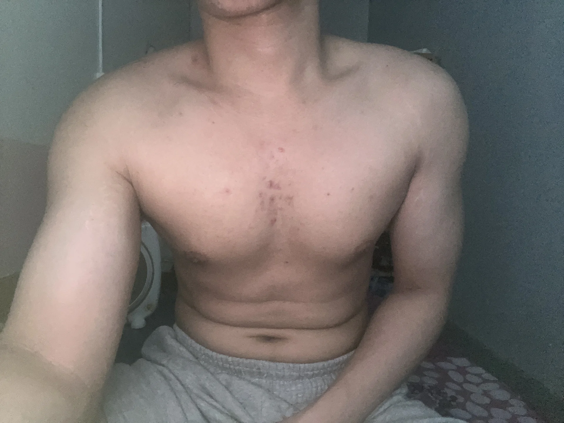 XXX Porn Photo of Nude danielhuynh 1