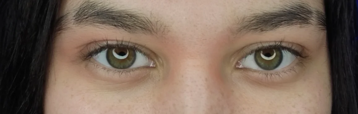 gollytiana